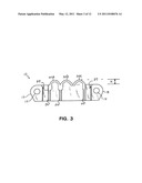 WATER SCREEN BELT MODULE diagram and image