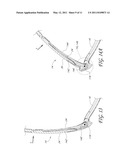 EYEGLASS EARSTEM WITH ENHANCED PERFORMANCE diagram and image