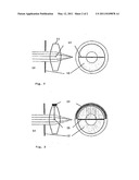 IMPLANTABLE SYSTEM FOR DETERMINING THE ACCOMMODATION REQUIREMENT BY OPTICAL MEASUREMENT OF THE PUPIL DIAMETER AND THE SURROUNDING LUMINANCE diagram and image