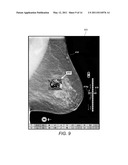 Selective Display Of Computer-Aided Detection Findings With Associated Breast X-Ray Mammogram and/or Tomosynthesis Image Information diagram and image