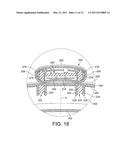 FAN diagram and image