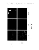 COMPOSITIONS AND METHODS FOR THE TREATMENT OF NEOPLASIA diagram and image