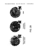 COMPOSITIONS AND METHODS FOR THE TREATMENT OF NEOPLASIA diagram and image