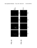 COMPOSITIONS AND METHODS FOR THE TREATMENT OF NEOPLASIA diagram and image