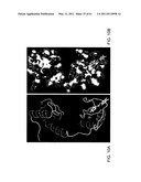 COMPOSITIONS AND METHODS FOR THE TREATMENT OF NEOPLASIA diagram and image