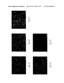 NOVEL IMMUNOGENIC PROTEINS OF LEPTOSPIRA diagram and image