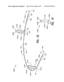 ORTHODONTIC APPARATUS AND METHOD diagram and image