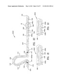 ORTHODONTIC APPARATUS AND METHOD diagram and image