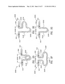 ORTHODONTIC APPARATUS AND METHOD diagram and image