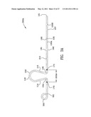 ORTHODONTIC APPARATUS AND METHOD diagram and image