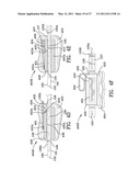 ORTHODONTIC APPARATUS AND METHOD diagram and image