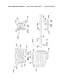 ORTHODONTIC APPARATUS AND METHOD diagram and image