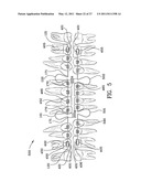 ORTHODONTIC APPARATUS AND METHOD diagram and image