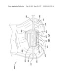 ORTHODONTIC APPARATUS AND METHOD diagram and image