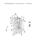 ORTHODONTIC APPARATUS AND METHOD diagram and image