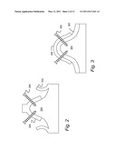 METHOD FOR REALIZING AN AXIAL TRAJECTORY IN A SURGICAL DRILLING PROCESS diagram and image