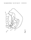 METHOD FOR REALIZING AN AXIAL TRAJECTORY IN A SURGICAL DRILLING PROCESS diagram and image