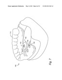 METHOD FOR REALIZING AN AXIAL TRAJECTORY IN A SURGICAL DRILLING PROCESS diagram and image