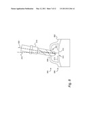 COMPUTER-AIDED DESIGN OF A DRILL GUIDE WITH A WINDOW diagram and image