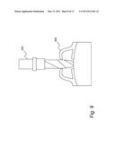 COMPUTER-AIDED DESIGN OF A DRILL GUIDE WITH A WINDOW diagram and image