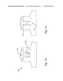 COMPUTER-AIDED DESIGN OF A DRILL GUIDE WITH A WINDOW diagram and image