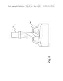 COMPUTER-AIDED DESIGN OF A THIN-LAYER DRILL GUIDE diagram and image