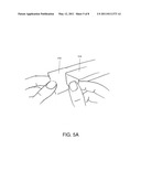 Full Arch Dental Treatment Devices and Systems diagram and image