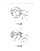 Full Arch Dental Treatment Devices and Systems diagram and image