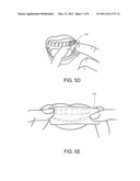 Full Arch Dental Treatment Devices and Systems diagram and image