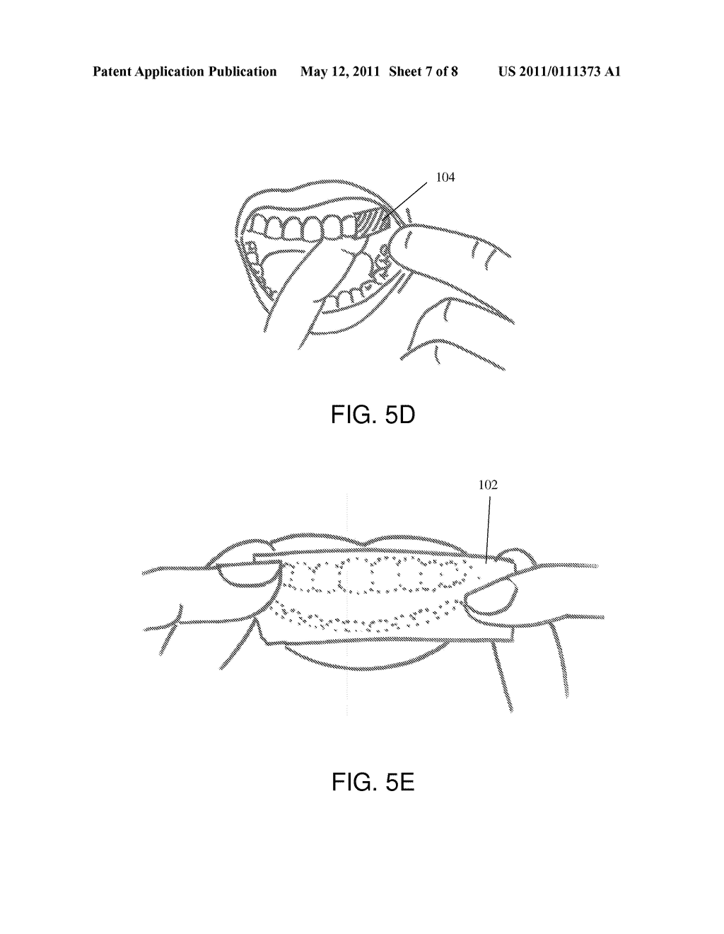 Full Arch Dental Treatment Devices and Systems - diagram, schematic, and image 08