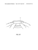 Full Arch Dental Treatment Devices and Systems diagram and image