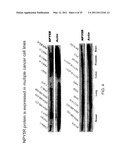 METHOD OF TREATING CANCER USING A NEUROPEPTIDE Y 5R (NP Y5R) ANTAGONIST diagram and image