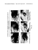 METHOD OF TREATING CANCER USING A NEUROPEPTIDE Y 5R (NP Y5R) ANTAGONIST diagram and image