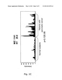 NOVEL TUMOR MARKER FOR PANCREATIC CANCER diagram and image