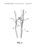 APPARATUS AND METHOD FOR ELECTROMAGNETIC TREATMENT diagram and image