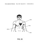 APPARATUS AND METHOD FOR ELECTROMAGNETIC TREATMENT diagram and image