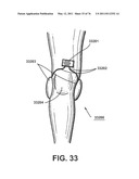 APPARATUS AND METHOD FOR ELECTROMAGNETIC TREATMENT diagram and image