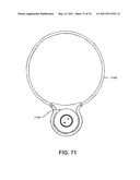 APPARATUS AND METHOD FOR ELECTROMAGNETIC TREATMENT diagram and image