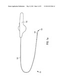 MINIMALLY INVASIVE SURGICAL STABILIZATION DEVICES AND METHODS diagram and image