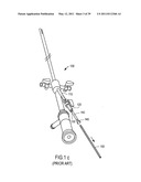 MINIMALLY INVASIVE SURGICAL STABILIZATION DEVICES AND METHODS diagram and image