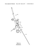 MINIMALLY INVASIVE SURGICAL STABILIZATION DEVICES AND METHODS diagram and image