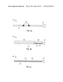 MINIMALLY INVASIVE SURGICAL STABILIZATION DEVICES AND METHODS diagram and image