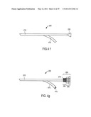 MINIMALLY INVASIVE SURGICAL STABILIZATION DEVICES AND METHODS diagram and image