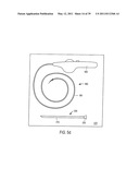 MINIMALLY INVASIVE SURGICAL STABILIZATION DEVICES AND METHODS diagram and image