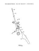 MINIMALLY INVASIVE SURGICAL STABILIZATION DEVICES AND METHODS diagram and image