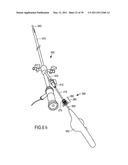 MINIMALLY INVASIVE SURGICAL STABILIZATION DEVICES AND METHODS diagram and image