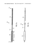 MINIMALLY INVASIVE SURGICAL STABILIZATION DEVICES AND METHODS diagram and image