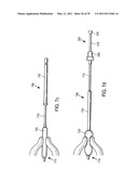 MINIMALLY INVASIVE SURGICAL STABILIZATION DEVICES AND METHODS diagram and image