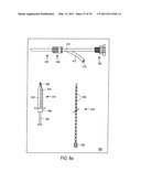 MINIMALLY INVASIVE SURGICAL STABILIZATION DEVICES AND METHODS diagram and image