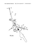 MINIMALLY INVASIVE SURGICAL STABILIZATION DEVICES AND METHODS diagram and image